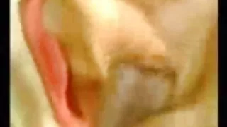 एक बिंदु में एक गुड़िया टक्कर लगी है और गुदा में एक बड़ा छेद फेंक दिया